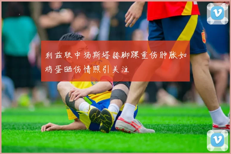 利兹联中场斯塔赫脚踝重伤肿胀如鸡蛋晒伤情照引关注